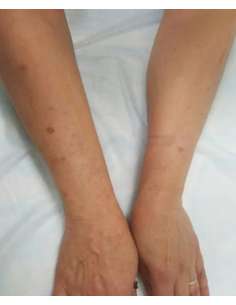 Soin Apaisant & Anti-rougeurs - Visage & Corps 2