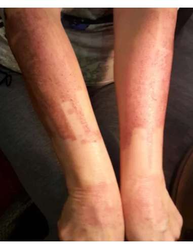 Soin Extrême -CEBELIA