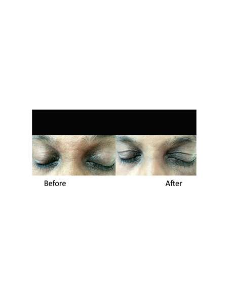 MESOPEEL ARGILAC MESOPEEL ARGILAC