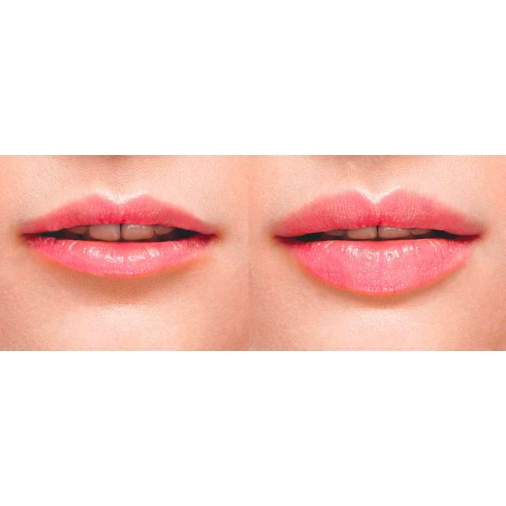 Dermhage Lips - L'ESTHETIC PARIS