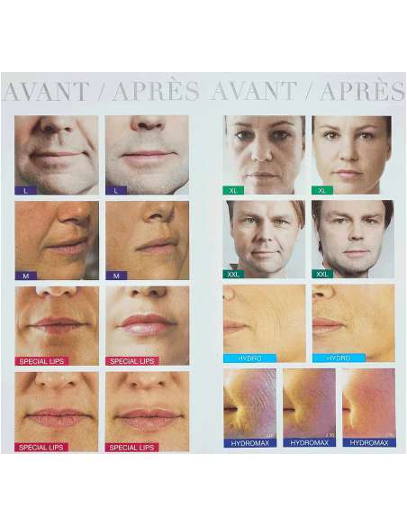 STYLAGE M Lidocaïne (2x1ml) - VIVACY