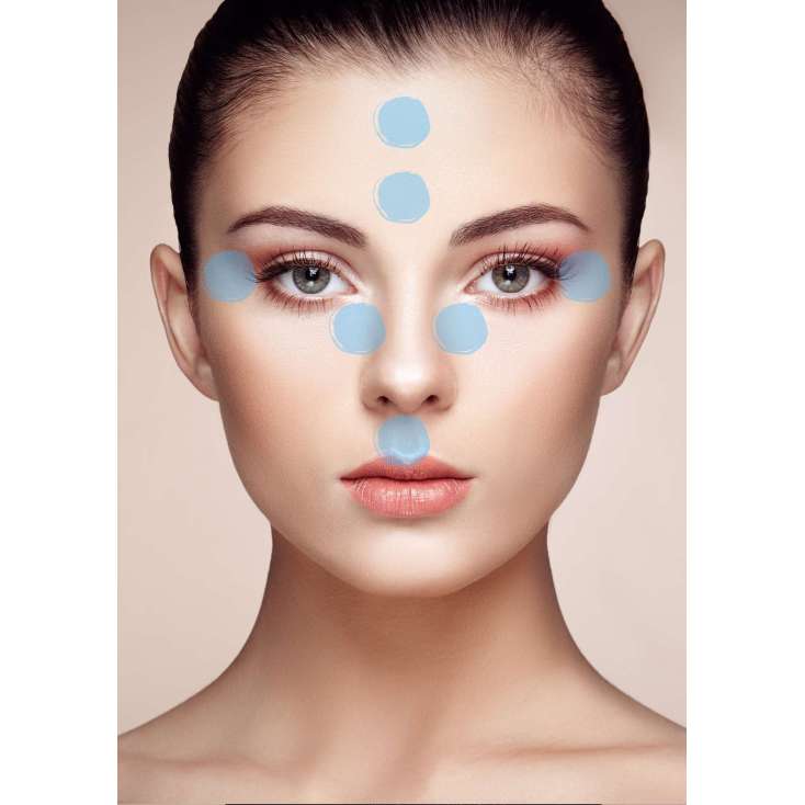 JUVÉDERM® VOLBELLA ® avec Lidocaine