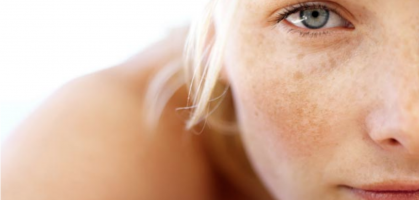 7 ways to fight brown spots on the face